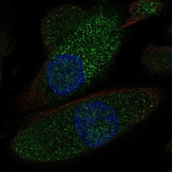 NKCC2/SLC12A1 Antibody, Novus Biologicals:Antibodies:Primary Antibodies